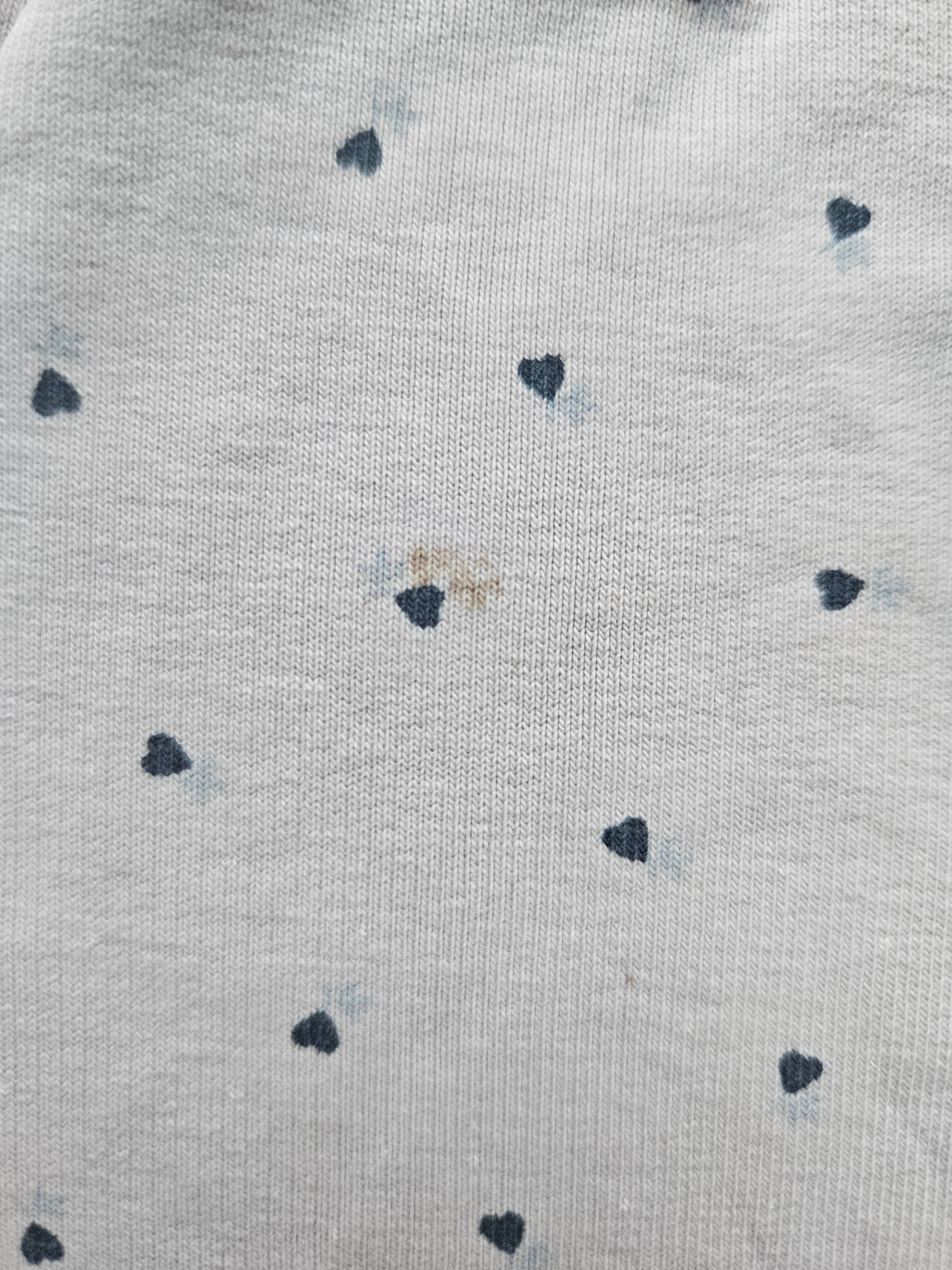 Sanetta Fiftyseven Herzchenkleid 💙 | Gr. 74
